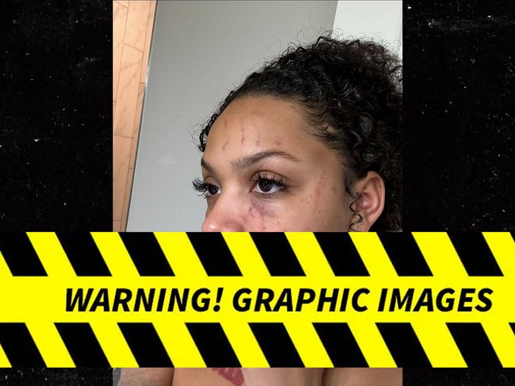 Photos shared by Dacoda Jones showing apparent bruising; she alleged the injuries were caused by an ex-partner.