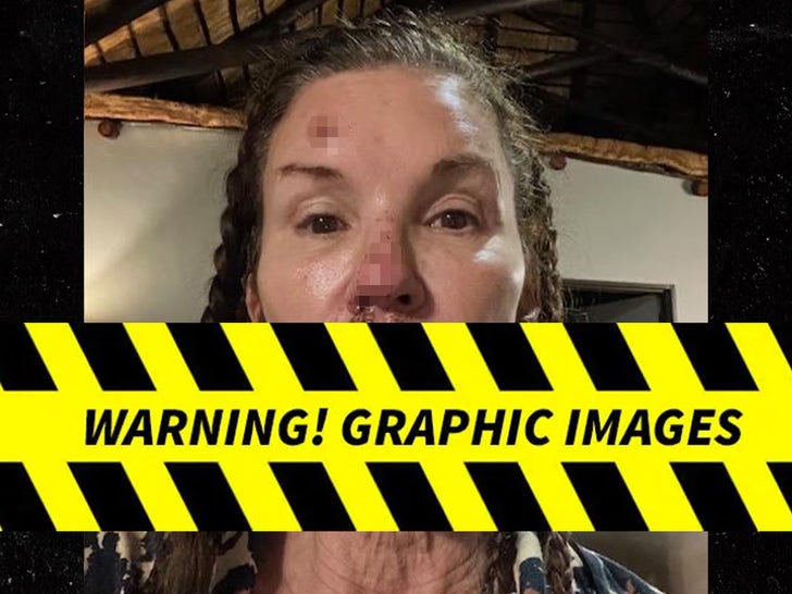 Close-up images showing Janice Dickinson's facial injuries she alleges occurred during filming of I'm A Celebrity... South Africa.