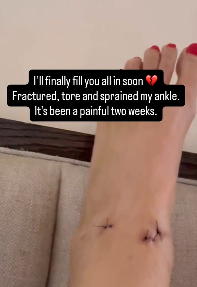Bella shared a picture of her damaged foot - it is unknown how long it will take to recover