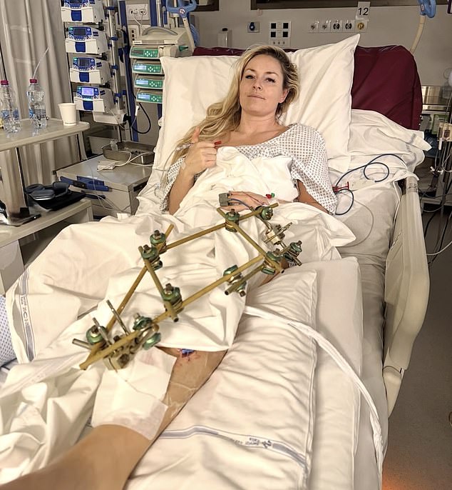 Lindsey Vonn recovering in a hospital bed after multiple surgeries on her injured leg.