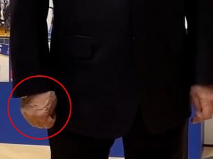 Close-up still of Putin's right hand under his jacket sleeve during a 2025 meeting, which drew online speculation