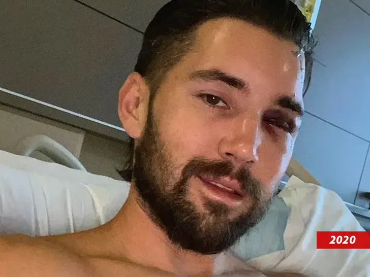 Jeff Wittek in a hospital selfie during recovery after the excavator accident