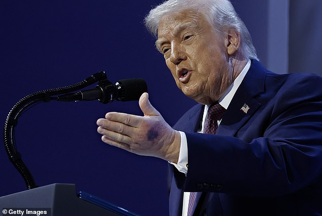 Trump speaks in Davos, Switzerland; the White House has attributed visible hand bruising to frequent handshakes and daily aspirin